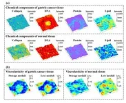 Cracking the structure of a crucial neural transport protein 3