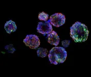 Creation of 3D organoid models to fine-tune radiation dose for nasopharyngeal cancer