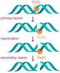 Cutting cancer to pieces: New research on bleomycin 2