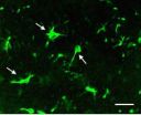 Dab2: How to attenuate brain injury due to Alzheimers disease?