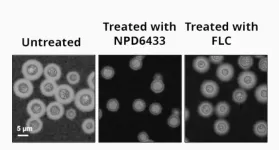 Deadly fungus beaten with new type of treatment