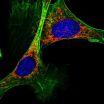 Deciphered the process through which cells optimize metabolism to burn sugars or fats