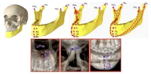 Deep-learning-based anatomical landmark identification in CT scans