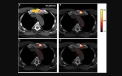 Deep learning-based whole-body PSMA PET/CT attenuation correction utilizing Pix-2-Pix GAN