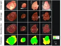 Deep Vision: Near-infrared imaging and machine learning can identify hidden tumors