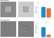 Depression affects visual perception