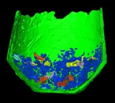 Detailed analysis of two Late Bronze Age urn burials uncovers animal bones and jewelry amidst the cremated remains of a woman and child, and reveals insights into prehistoric funerary rites