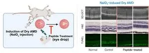 Development of a global innovative drug in eye drop form for treating dry age-related macular degeneration 2