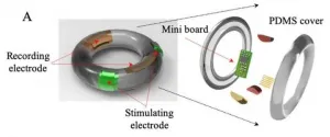 Development of an electroceutical to drastically reduce high-risk, preterm labor