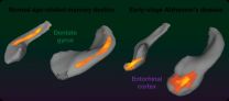 Dietary flavanols reverse age-related memory decline 3