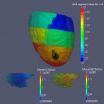 Diffeomorphometry and geodesic positioning systems for human anatomy