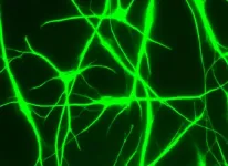 Differences in human, mouse brain cells have important implications for disease research