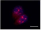 Discovered a new way to control genetic material altered in cancer