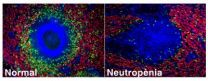 Discovered the existence of neutrophils in the spleen