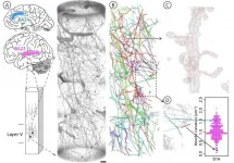 Discovering structural diverseness of neurons between brain areas and between cases