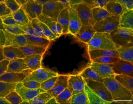 Discovery about wound healing key to understanding cell movement