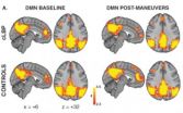 Discovery could eventually help diagnose and treat chronic pain 