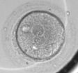 Discovery could improve in vitro fertilization success rates for women around the world 2