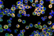 Discovery finds how ovarian cancer disables immune cells