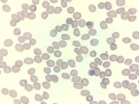 Discovery of critical iron-transport protein in malaria parasites could lead to faster-acting medications