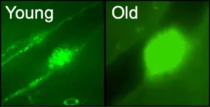 Distinct population of ‘troublemaker’ platelet cells appear with aging, lead to blood clotting, disease