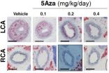 Disturbance in blood flow leads to epigenetic changes and atherosclerosis