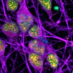 DNA damage hot spots discovered within neurons