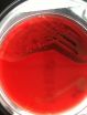 DNA data could help doctors treat MRSA shows new study