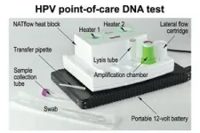 DNA test could broaden access to cervical cancer screening 2