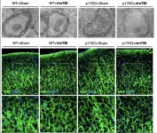 Drug could protect brains from damage after concussions