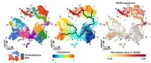 Ear today, gone tomorrow? A new discovery in a cause of inner-ear bone loss 2