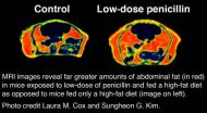 Early antibiotic exposure leads to lifelong metabolic disturbances in mice 3