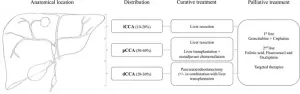 Early detection crucial in bile duct cancer for patients with rare liver disease