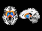 Eating habits, body fat related to differences in brain chemistry