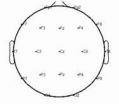 Effect of repeated-pulse transcranial magnetic stimulation at the Guangming point on EEGs