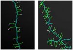 Effective drugs for Parkinsons reduce symptoms of Rett syndrome in mice