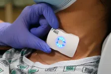 El Camino Health is first in the world to adopt FloPatch advanced ultrasound technology for sepsis management