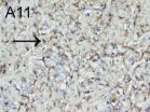 Electroacupuncture at Conception and Governor vessels and hUCB-MSCs for cerebral ischemia