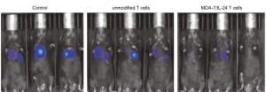 Engineering T cells to attack cancer broadly