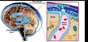 Enlarged spaces in infant brains linked to higher risk of autism, sleep problems 2