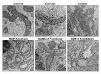 Epigenetic regulator MOF drives mitochondrial metabolism 2