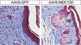 ERK activity is a molecular switch between tissue regeneration and scarring 3