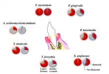 Esophageal cancer patients show abundance of oral pathogens