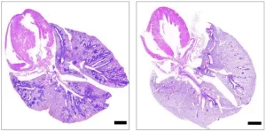 Existing drug shows promise as treatment for rare genetic disorder