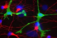 Experimental antibodies for Parkinsons, Alzheimers may cause harmful inflammation