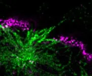 Exploring Huntington’s disease, researchers discover that protein aggregates poke holes in nuclear membrane 2