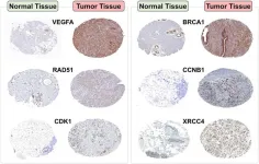 Exploring the role of seven key genes in breast cancer: insights from in silico and in vitro analyses