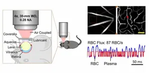 Eyeing the brain: Predicting cerebrovascular diseases with retinal imaging