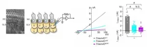 Facilitating speech comprehension in rare inherited hearing loss patients