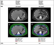 Fatty muscles raise the risk of serious heart disease regardless of overall body weight 3